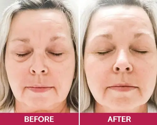 Evelyn Kern, 61 (Oklahoma)