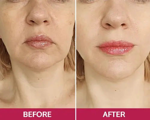 Patty Joe, 67 (Michigan)